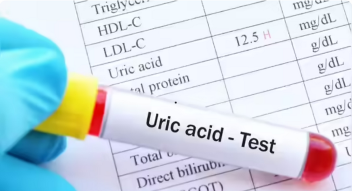 5 thực phẩm giúp giảm nồng độ axit uric nhanh chóng