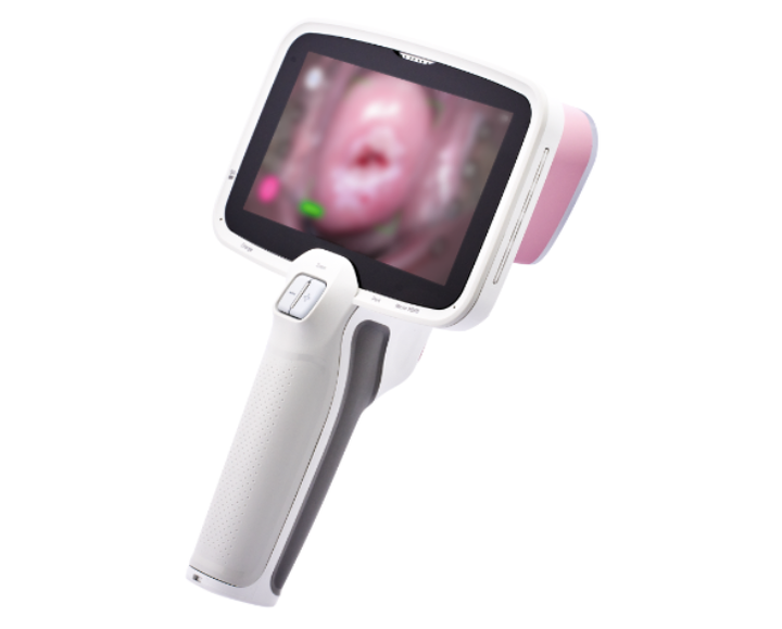 Thiết bị CerviCARE® AI – công cụ sàng lọc ung thư cổ tử cung bằng trí tuệ nhân tạo do NTL Healthcare phát triển.