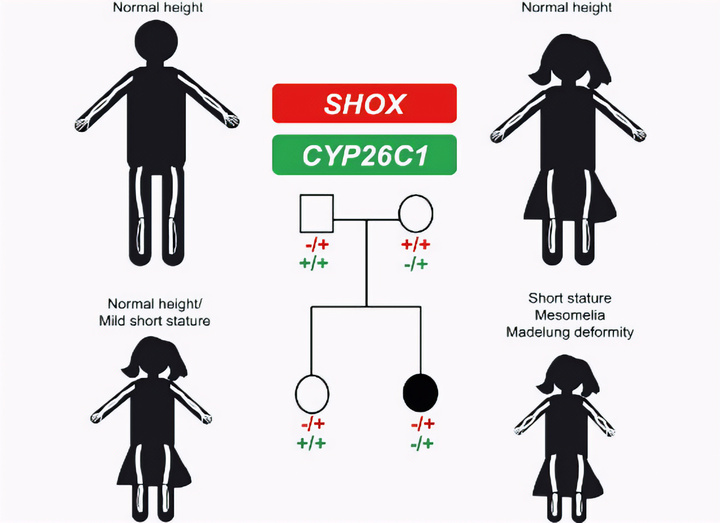ការបង្ហាញហ្សែន SHOX និង CYP26C1 ប៉ះពាល់ដល់កម្ពស់ និងការខូចទ្រង់ទ្រាយឆ្អឹង។ (ប្រភព៖ Embopress)