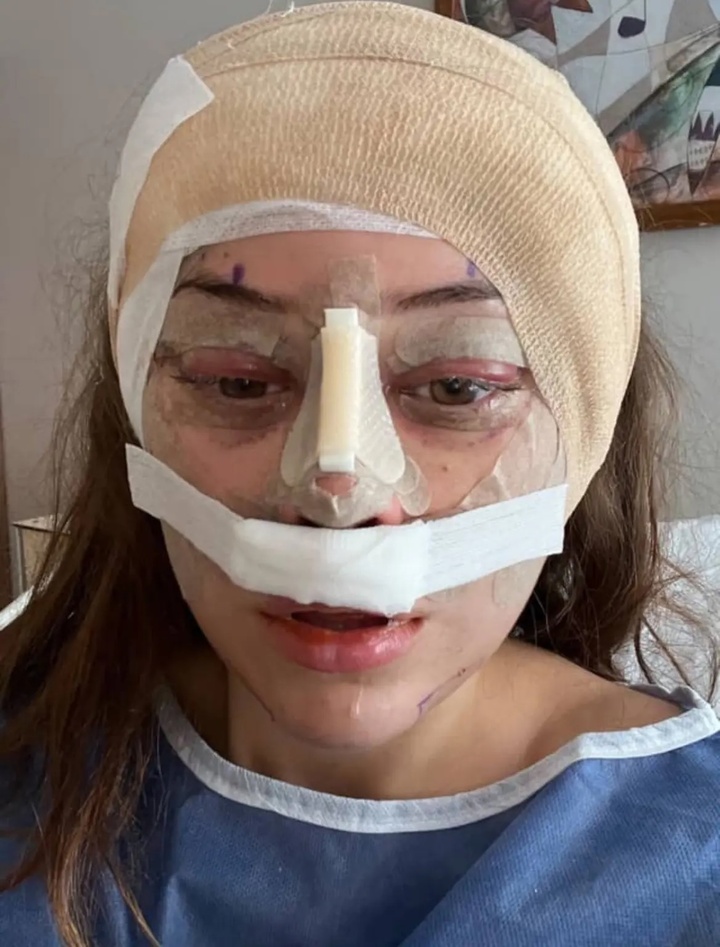 Cipryk là một trong số ngày càng nhiều phụ nữ lựa chọn các thủ thuật xâm lấn sâu.