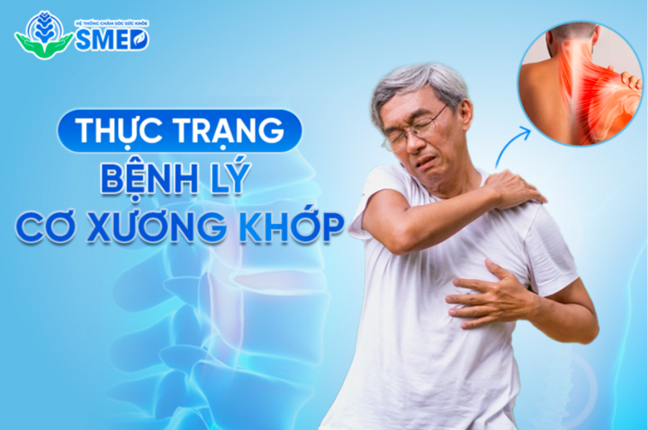 Thực trạng bệnh lý cơ xương khớp trong xã hội