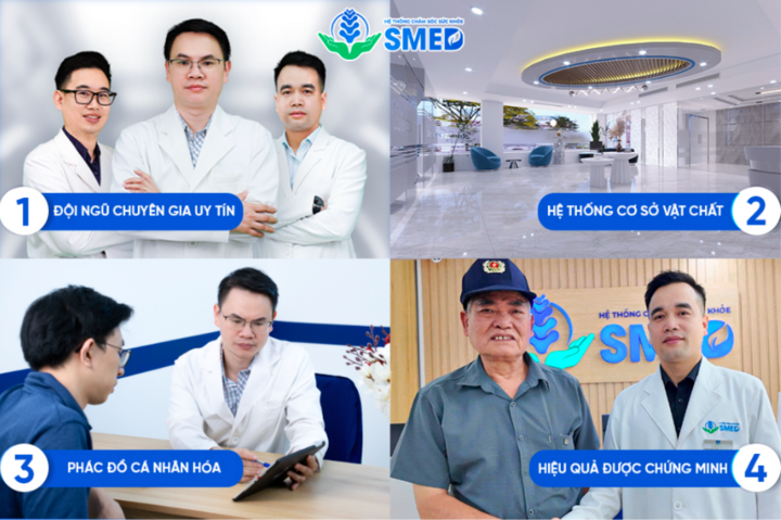 Bốn điểm khác biệt tại SMED