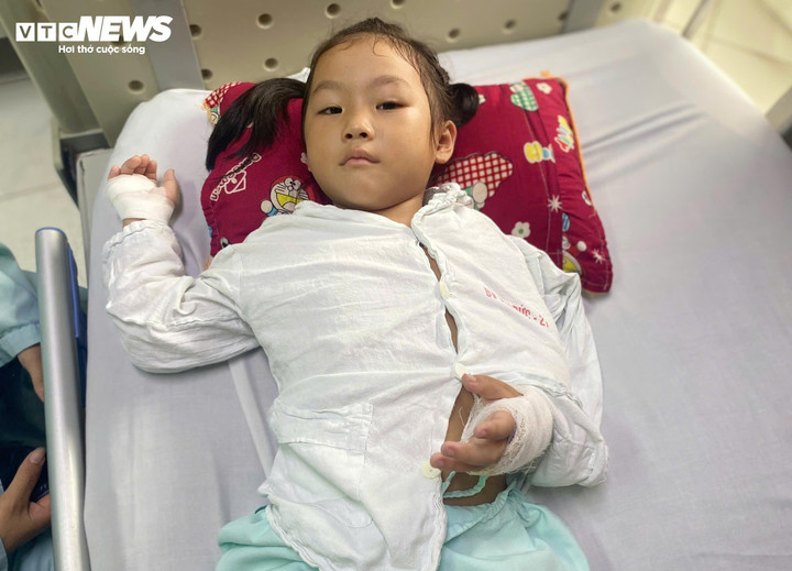 Bé Ly được chẩn đoán gãy xương cánh tay, phải mổ kết hợp xương. (Ảnh: Phương Anh)