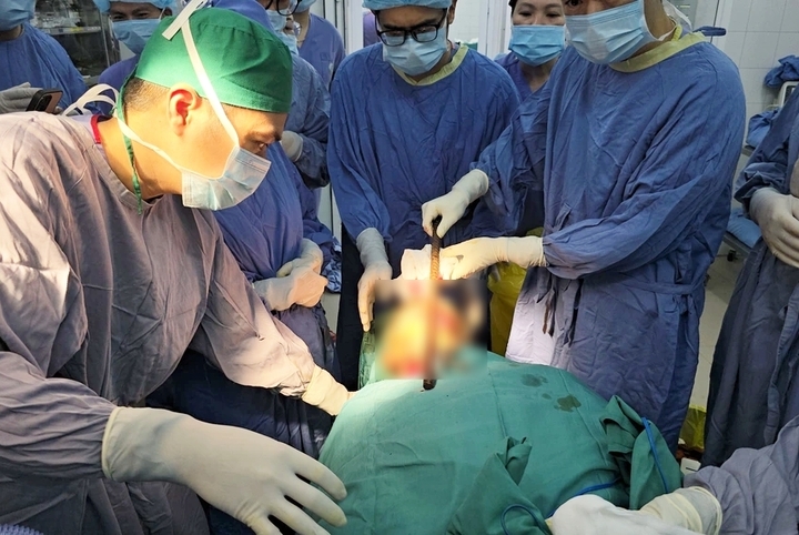 Bác sĩ phẫu thuật cấp cứu lấy dị vật xuyên vùng mặt - cổ.