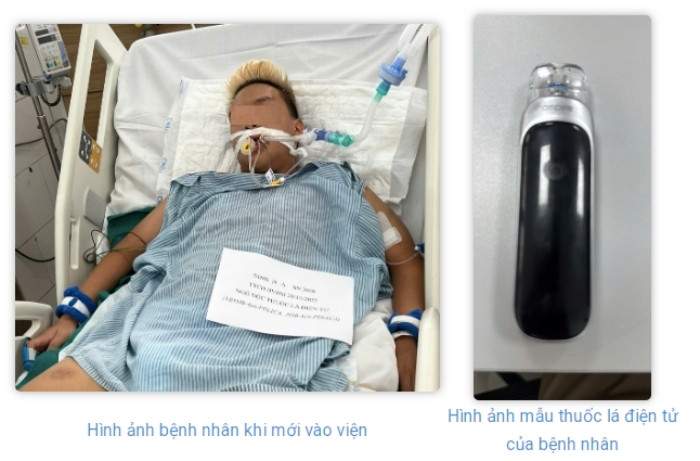 Suy thận, phổi tắc nghẽn vì hút thuốc lá điện tử từ năm 13 tuổi - 1