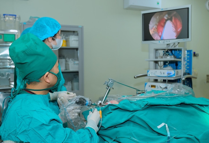 Bác sĩ phẫu thuật nội soi vi phẫu thanh quản cắt u hạt bằng Laser CO₂. (Ảnh: BVCC)