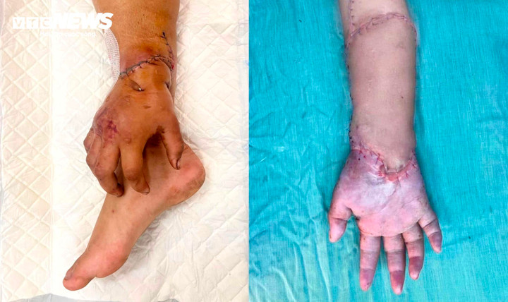 Sau hơn 2 tháng được 