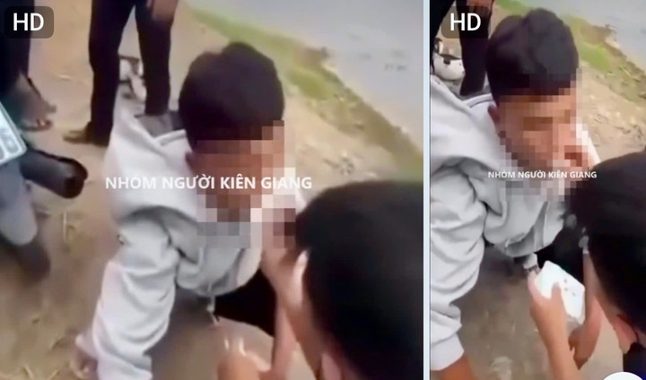 En manlig student fick en binda stoppad i munnen av en grupp vänner. (Foto: klippt från sociala medier)