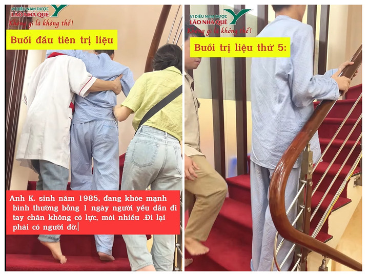 Anh K. bệnh nhân mắc kháng thể tự miễn tiêu cơ vân trị liệu tại Phòng khám chuyên khoa YHCT Lão Nhà Quê