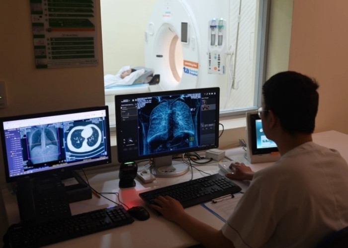 Tầm soát ung thư phổi bằng máy chụp cắt lớp vi tính. (Ảnh: BVCC)