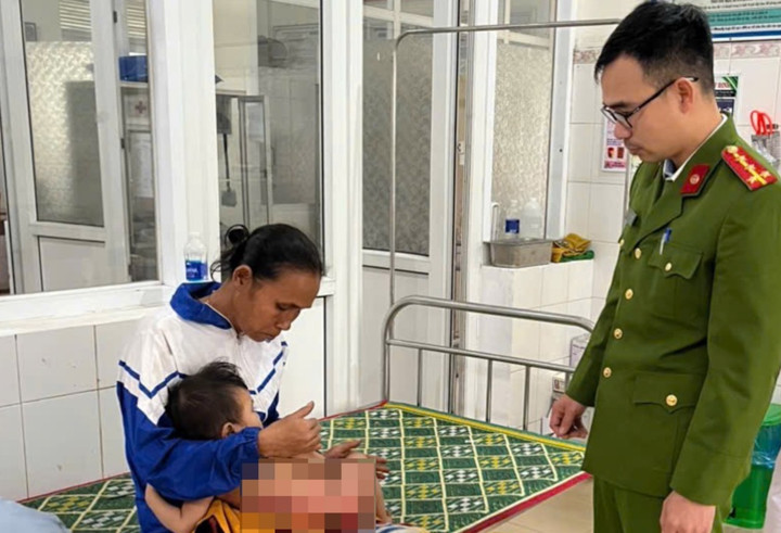 Nhờ được cấp cứu kịp thời vết bỏng của cháu bé hạn chế bị tổn thương