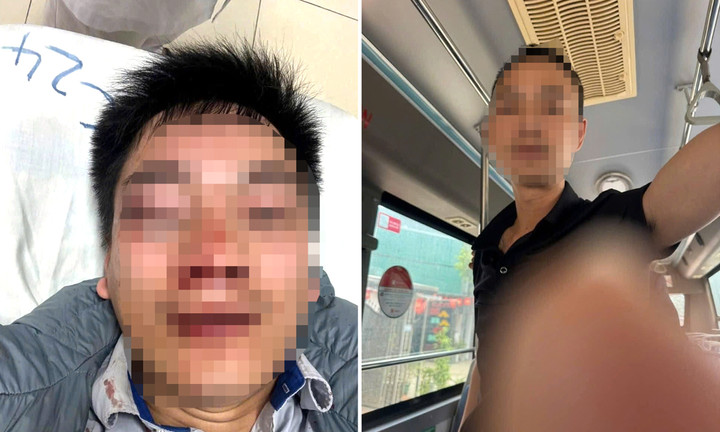 Lái xe và người hành hung.