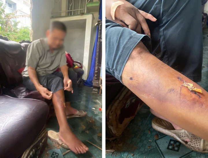 Theo UBND phường Phú Xuân, nạn nhân là người nghiện rượu nặng, thường xuyên đi lang thang. (Ảnh: V.T)