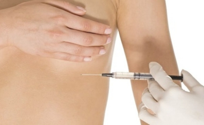Nâng ngực bằng tiêm filler tiềm ẩn nhiều rủi ro khó lường. (Ảnh minh hoạ)