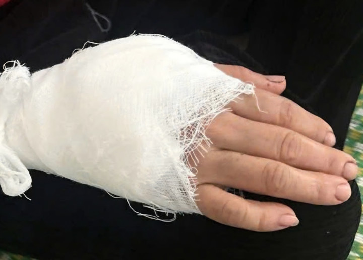 Người dân bị khỉ tấn công.