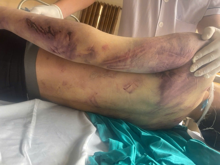 Nam học viên tử vong sau 2 ngày nhập học tại Trung tâm Công tác xã hội Hải Hà với nhiều vết thương trên cơ thể.