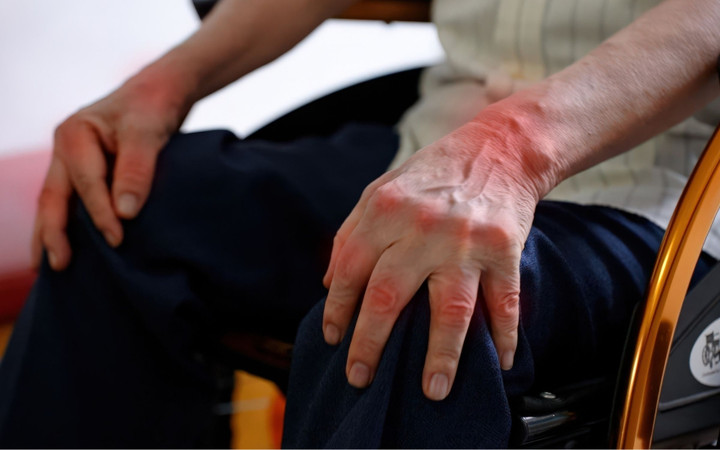 Tình trạng sưng đau xuất hiện ở nhiều khớp đối xứng.