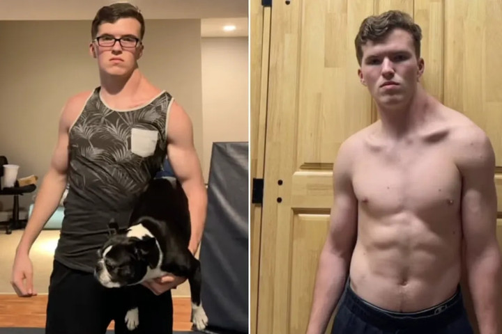 Chàng trai 19 tuổi với thân hình không cân đối. (Ảnh: Instagram)