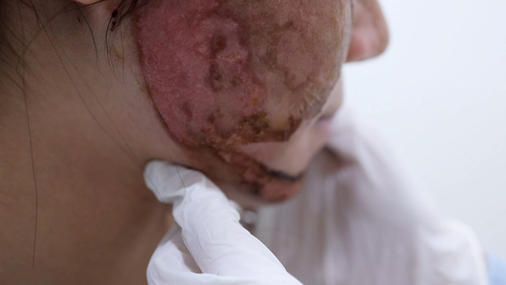 Sử dụng phương pháp làm đẹp không an toàn có thể dẫn tới nhiều biến chứng nghiêm trọng.