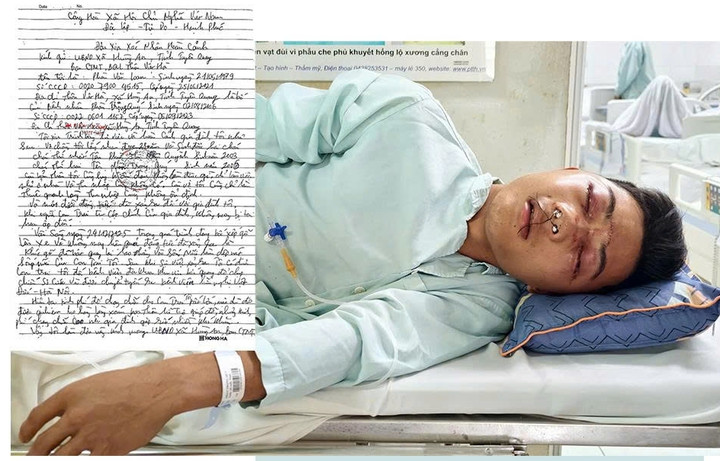 Phàn Trọng Quý, 19 tuổi ở Tuyên Quang, gặp tai nạn bốc gỗ dẫn đến đa chấn thương