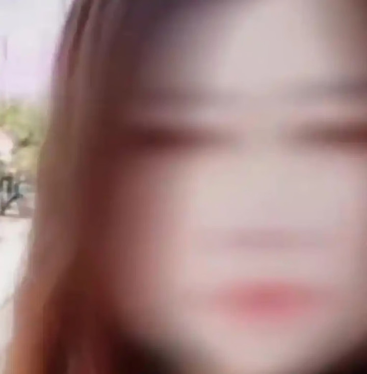 Cô Lý từng là người phụ nữ xinh xắn trước khi căn bệnh ngoài da làm tóc rụng từng mảng. (Ảnh: Baidu)