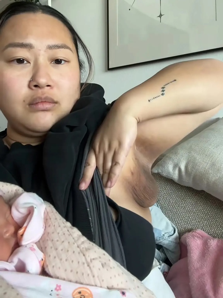 Mamiya cho biết phần mô thừa có thể sưng và đau nếu cô không cho con bú thường xuyên.