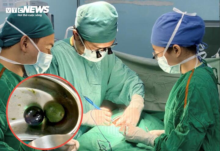 Ê-kíp thực hiện phẫu thuật mở ruột lấy dị vật cho bé gái 18 tháng tuổi.