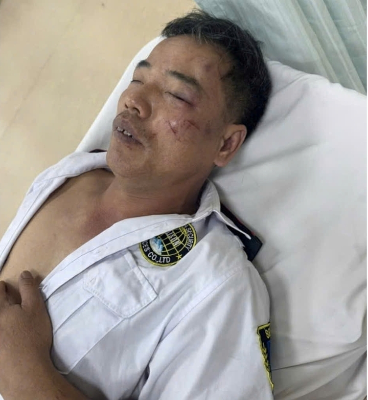 Nạn nhân bị gãy xương sườn và đa chấn thương. (Ảnh: B.L)