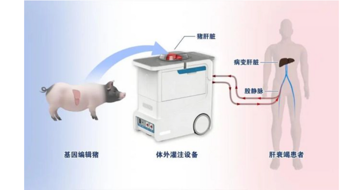 Sơ đồ mô phỏng liệu pháp tưới máu ngoài cơ thể bằng gan lợn chỉnh sửa 6 gen (Ảnh: 163.com)