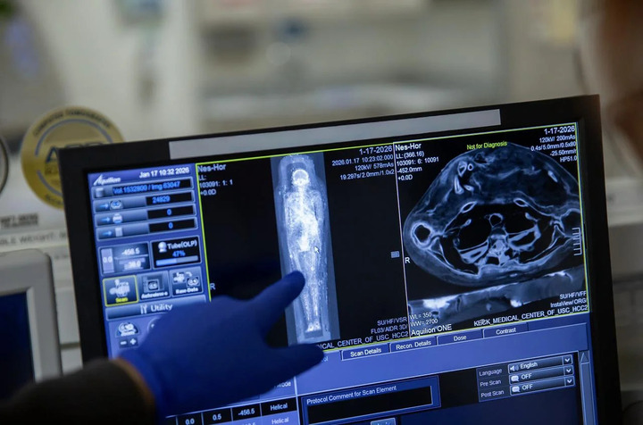 Hình ảnh xác ướp Ai Cập Nes-Hor được quét CT toàn thân tại Bệnh viện Keck thuộc Đại học Nam California. (Ảnh: Ricardo Carrasco III)