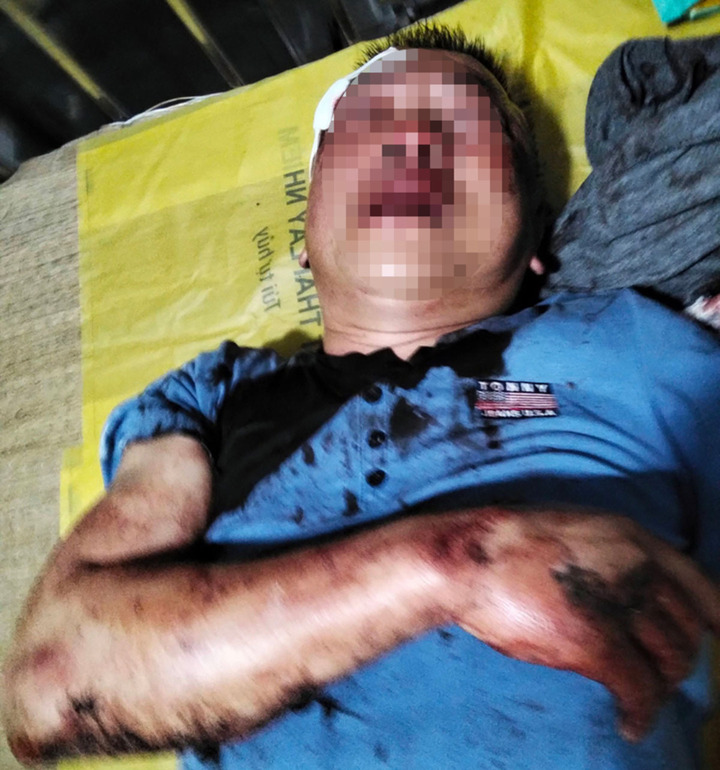 Ông V.V.K, (ở phường Hòa Bình, TP Hải Phòng) bị nhóm côn đồ hành hung dã man.