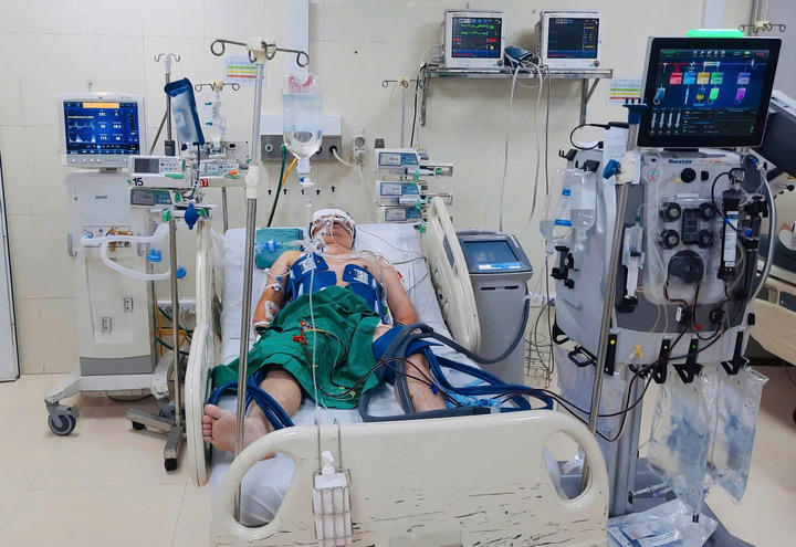 Ngừng tim gần 1 giờ, người đàn ông hôn mê sâu và suy đa tạng (Ảnh: BVCC).