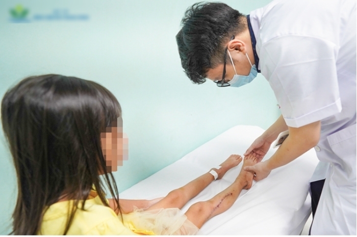 Bệnh nhi được kiểm tra mức độ hồi phục tại khoa Phục hồi chức năng.