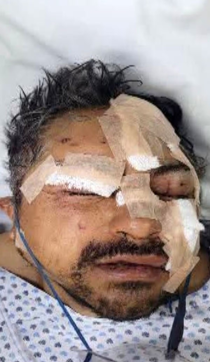 Người đàn ông bị thương nặng ở tay và mặt. (Ảnh: Jam Press)