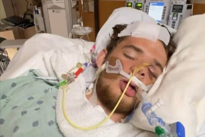 Gabe bị hôn mê suốt 18 ngày.