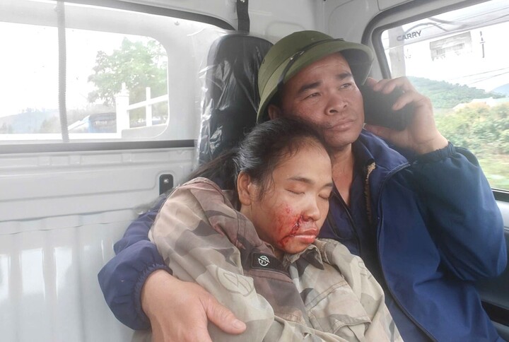 Chị Tơ Thị Bình bị thương trên xe công vụ của Công an xã Biển Động. (Ảnh: Công an Bắc Ninh).