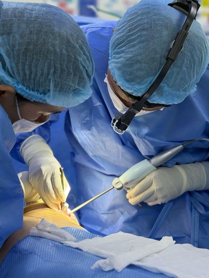 Nguyên nhân gây vỡ túi ngực sớm - 2