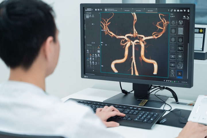 Với công nghệ tích hợp trí tuệ nhân tạo (AI), thiết bị cho phép tái tạo hình ảnh sắc nét đến từng milimet, giúp phát hiện sớm các tổn thương thần kinh, ung thư ngay từ giai đoạn đầu. Đồng thời, máy được cải tiến với thời gian chụp được rút ngắn, vận hành êm ái hơn, nâng cao trải nghiệm cho người bệnh.