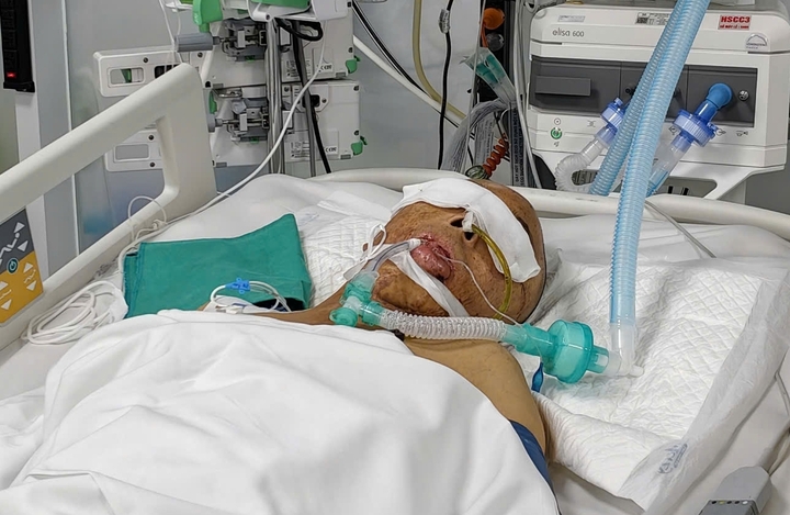 Trong phòng bệnh, máy thở, dây truyền dịch và các thiết bị theo dõi bao quanh giường bệnh. (Ảnh: Loan Hoà)