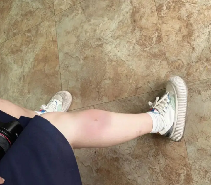 Những người thải ra nhiều khí carbon dioxide dễ thu hút muỗi.