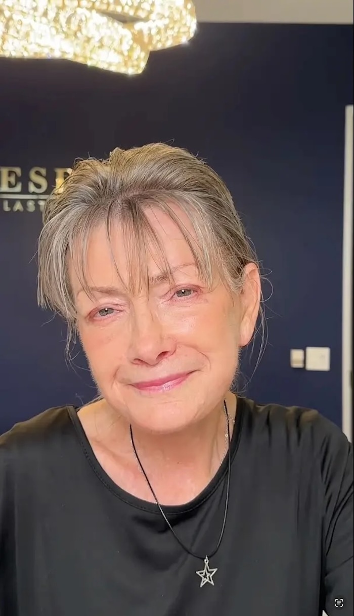 Khán giả hết lời khen ngợi kết quả phẫu thuật này.