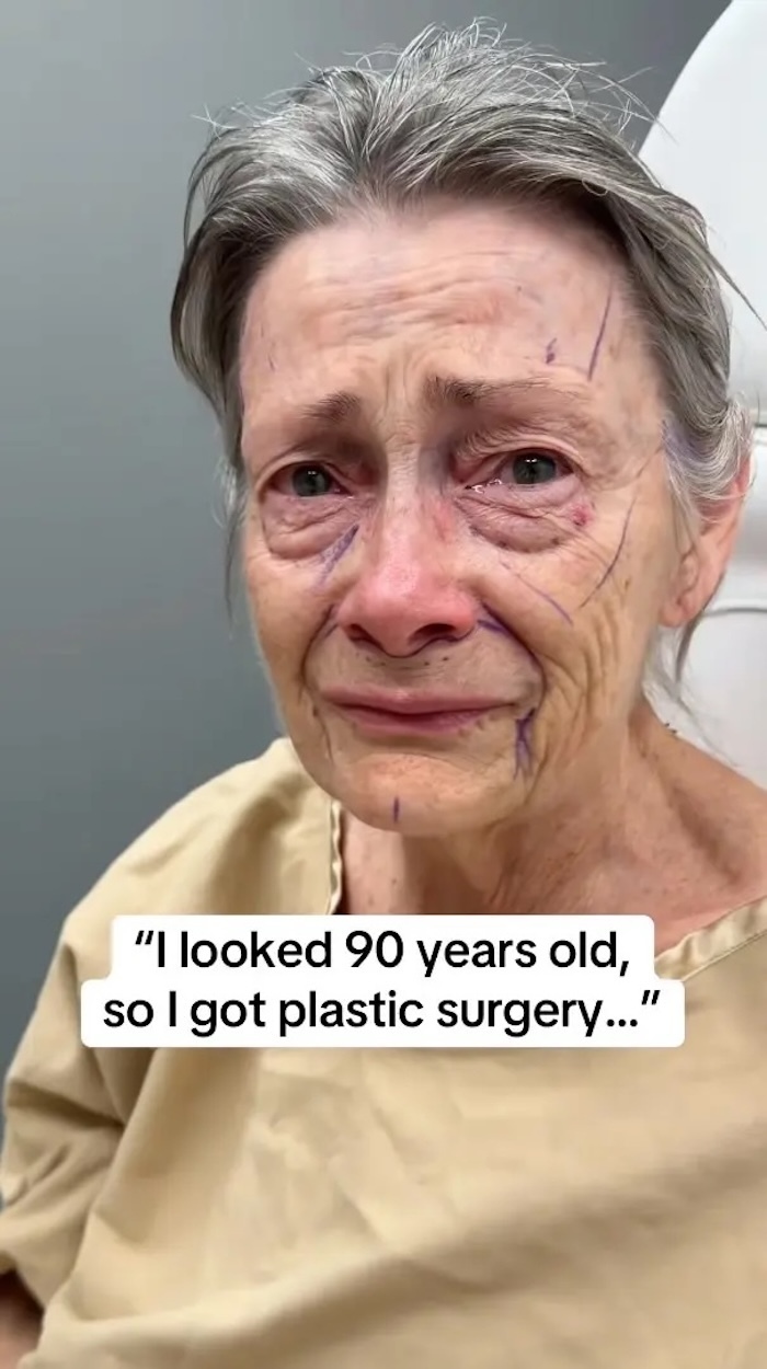 Bệnh nhân trước khi phẫu thuật nhìn như 90 tuổi.