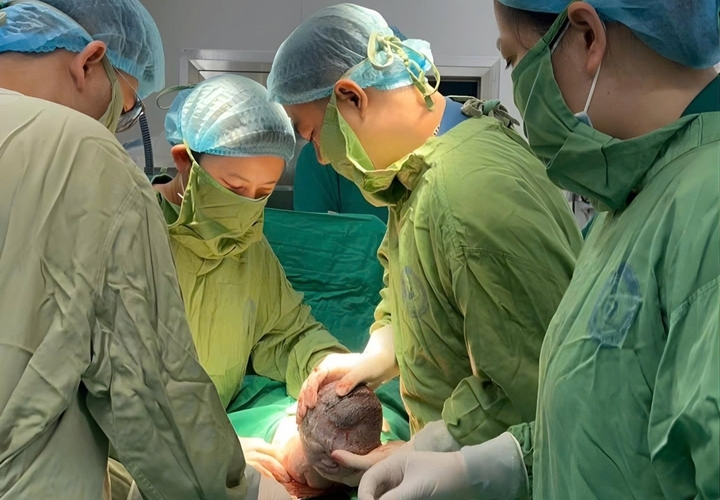 Các bác sĩ thực hiện ca mổ lấy thai cho bệnh nhân đặt dẫn lưu màng phổi thai nhi tuần thứ 32.