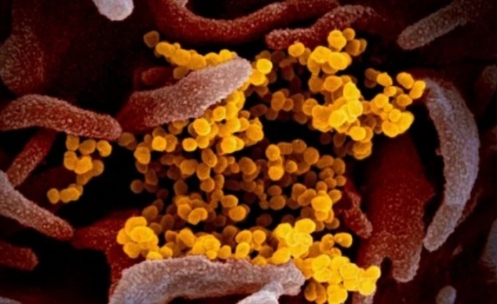 Biến thể COVID-19 mới BA.3.2 đang lan rộng tại Mỹ. (Ảnh: AP)