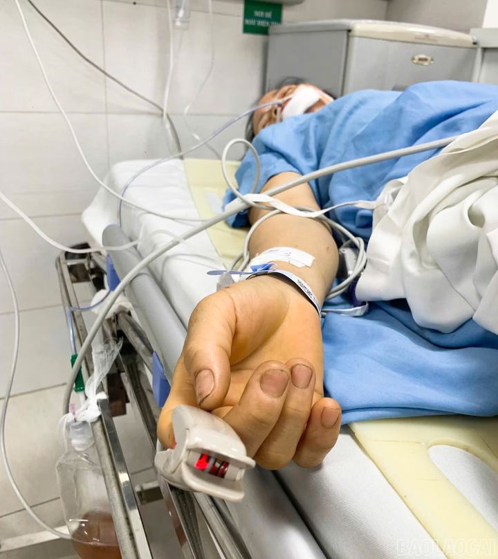 Chị Lường Thị Tỉnh đang điều trị tại Bệnh viện Hữu nghị Việt Đức.