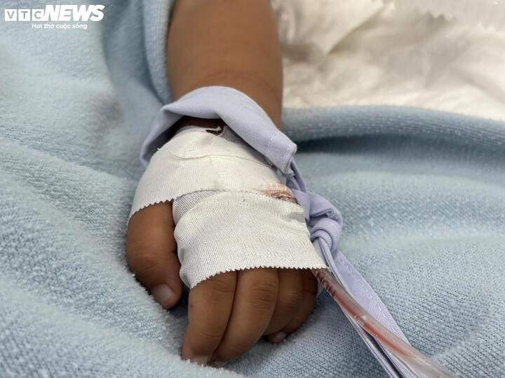 Nhiều trẻ mắc bệnh nặng do phụ huynh chủ quan cho trẻ nhập viện trễ.