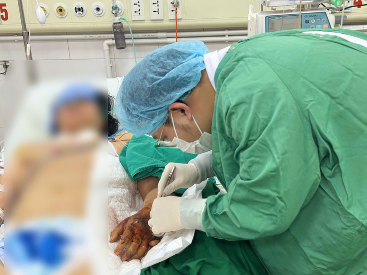 Bệnh nhân đang điều trị tại BV Bệnh Nhiệt đới Trung ương (Ảnh: BVCC)