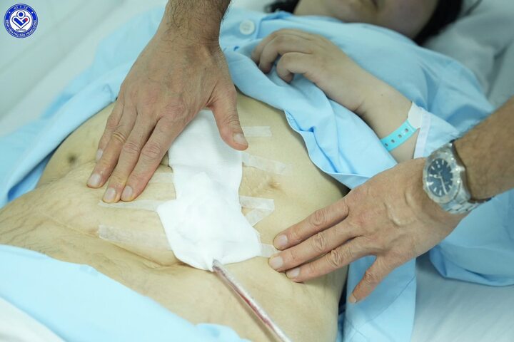 Bụng H chằng chịt những vết sẹo cũ (Ảnh: BVCC)