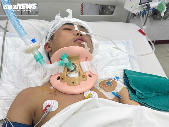 Dũng nằm trên giường, quanh người là dây truyền, ống thở và các thiết bị theo dõi. (Ảnh: Hiền Loan)