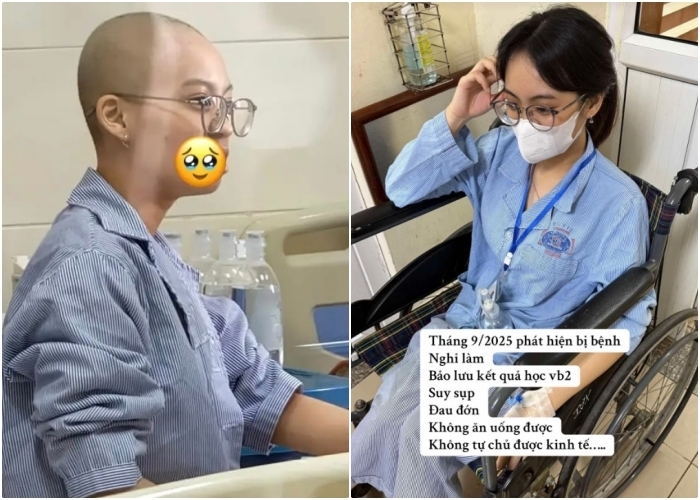 Hình ảnh Ngọc thời điểm nhập viện điều trị ung thư.